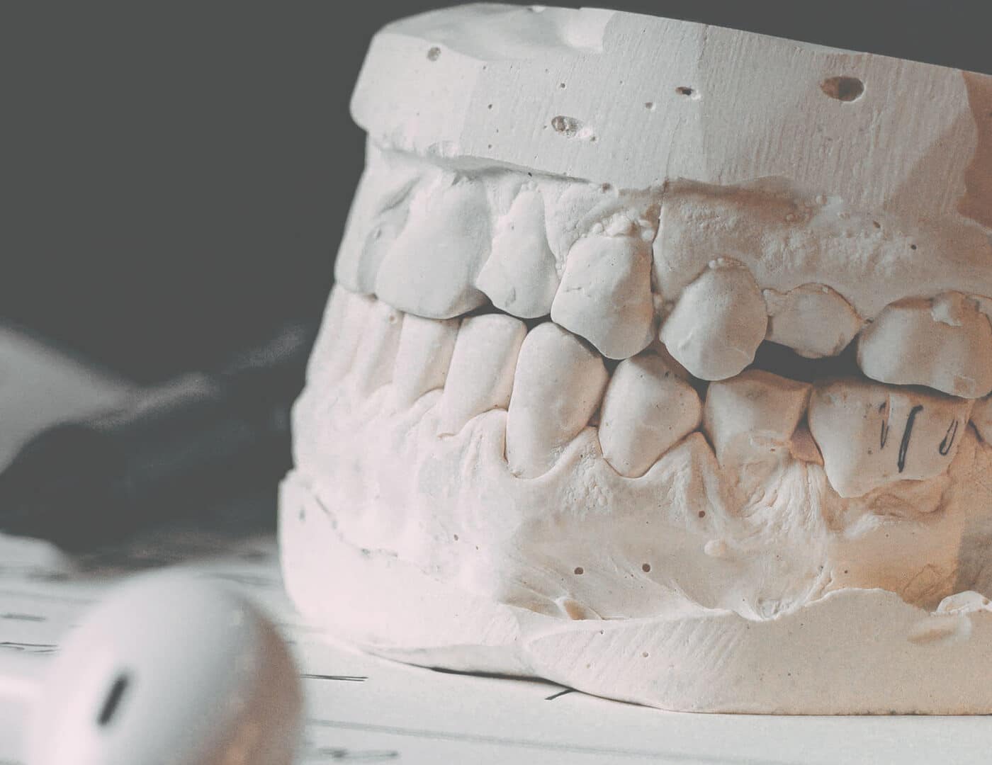 Prothèse dentaire Art et Sourire