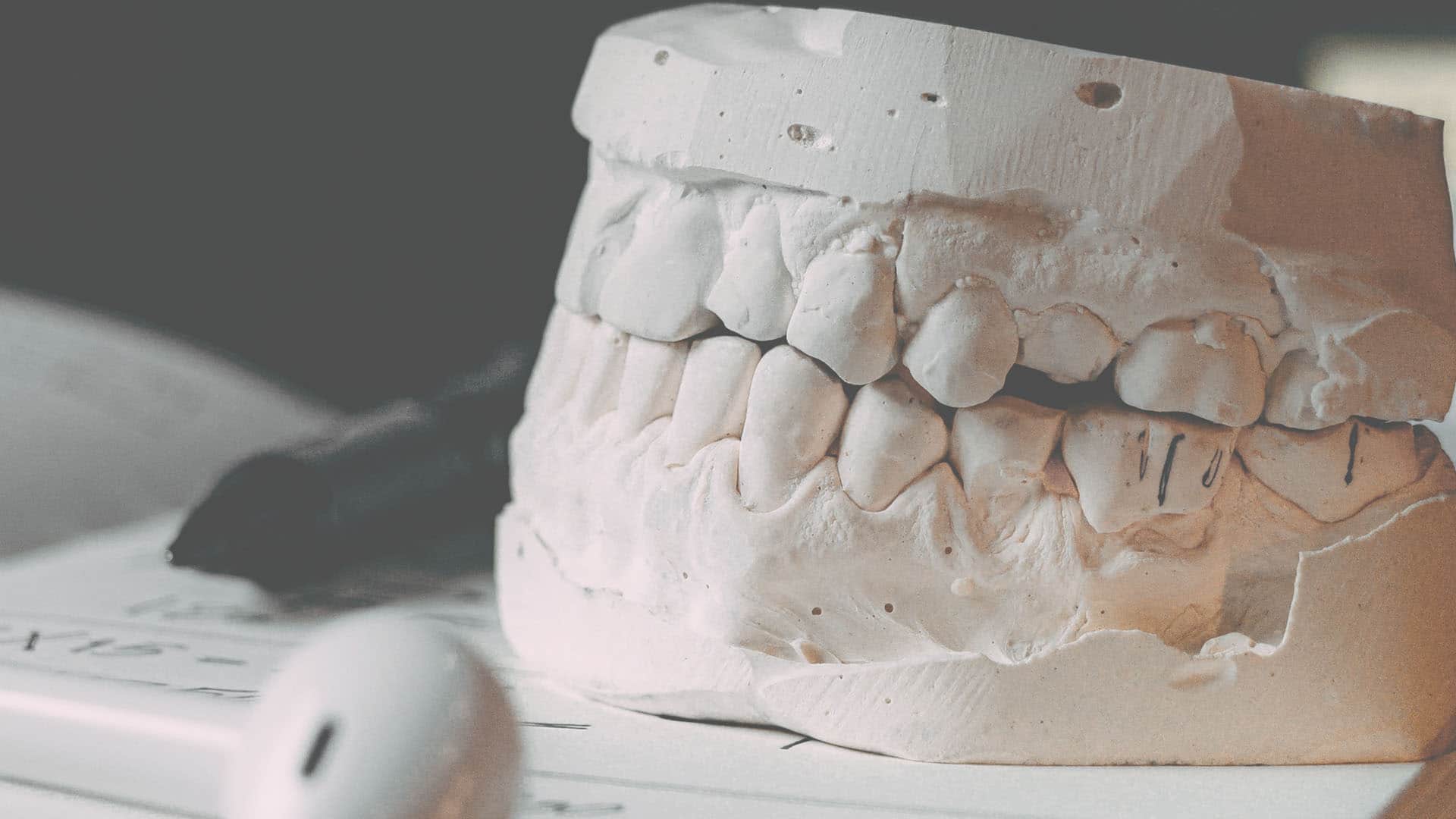 Prothèse dentaire Art et Sourire